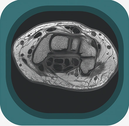 MRI wrist ligaments anatomy icon